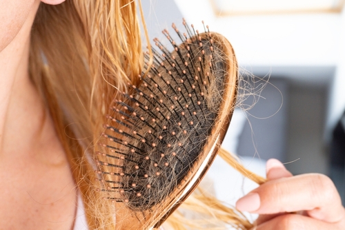 Caduta Capelli Stagionale: Cause e Rimedi Efficaci